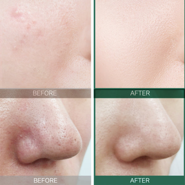 بلسم ميكسون سنتيلا ستيك