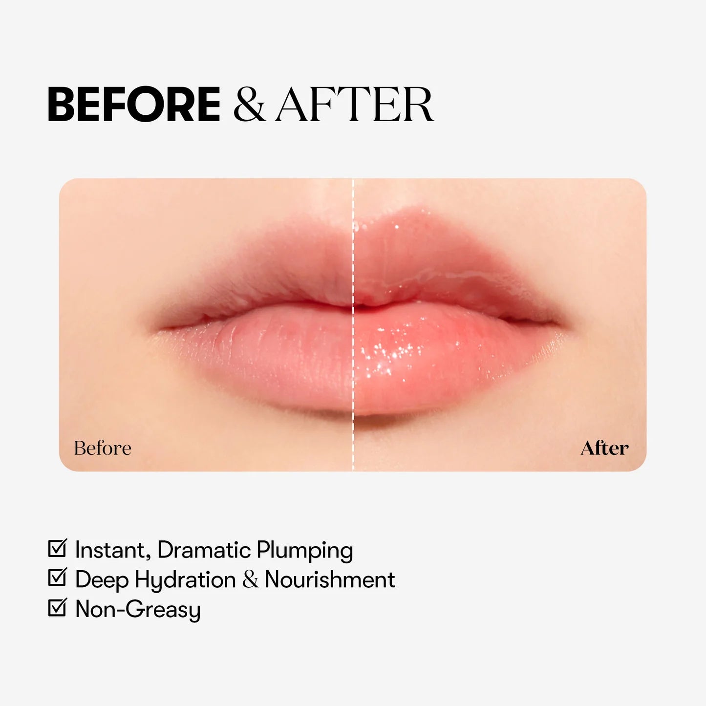 VT Cosmetics Reedle shot Lip Plumper Expert