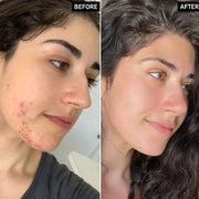 Beauty Of Joseon Glow Deep Serum : Rice +Alpha-Arbutin