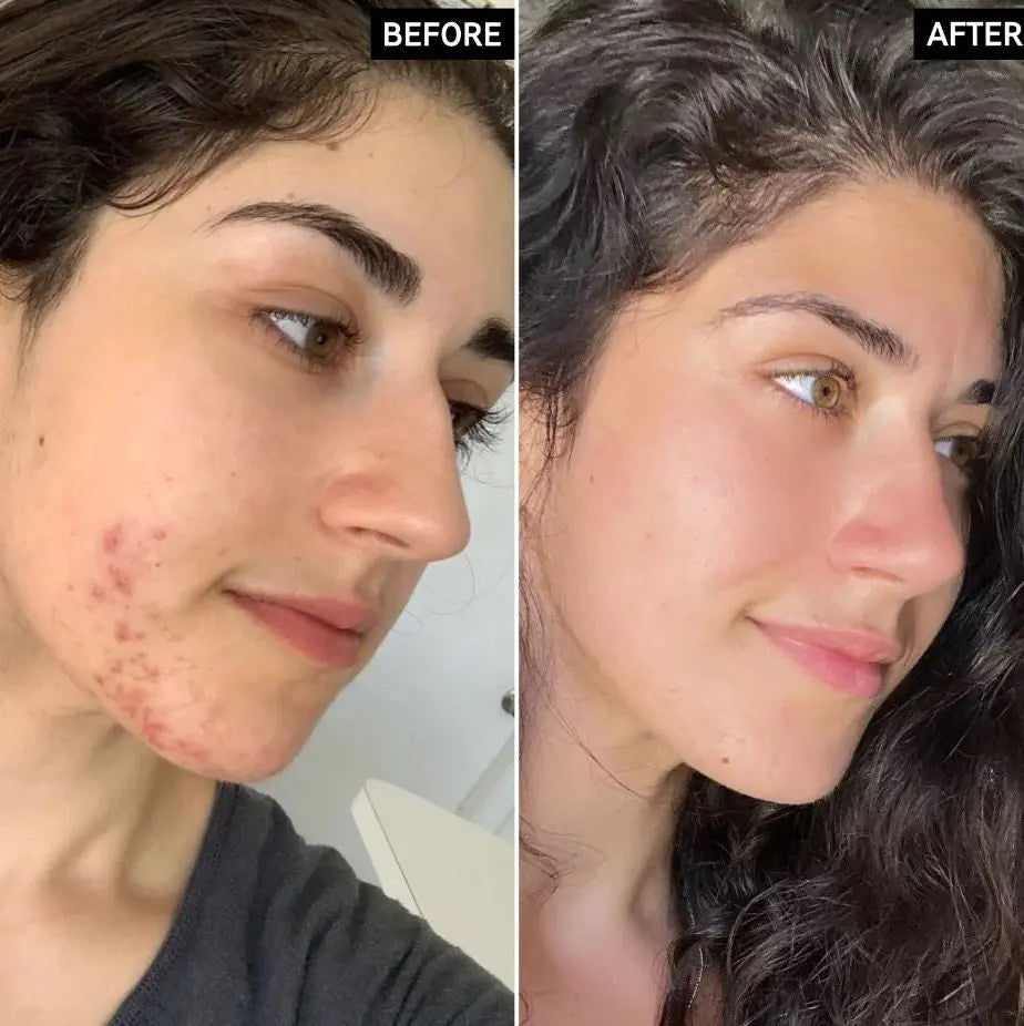 Beauty Of Joseon Glow Deep Serum : Rice +Alpha-Arbutin