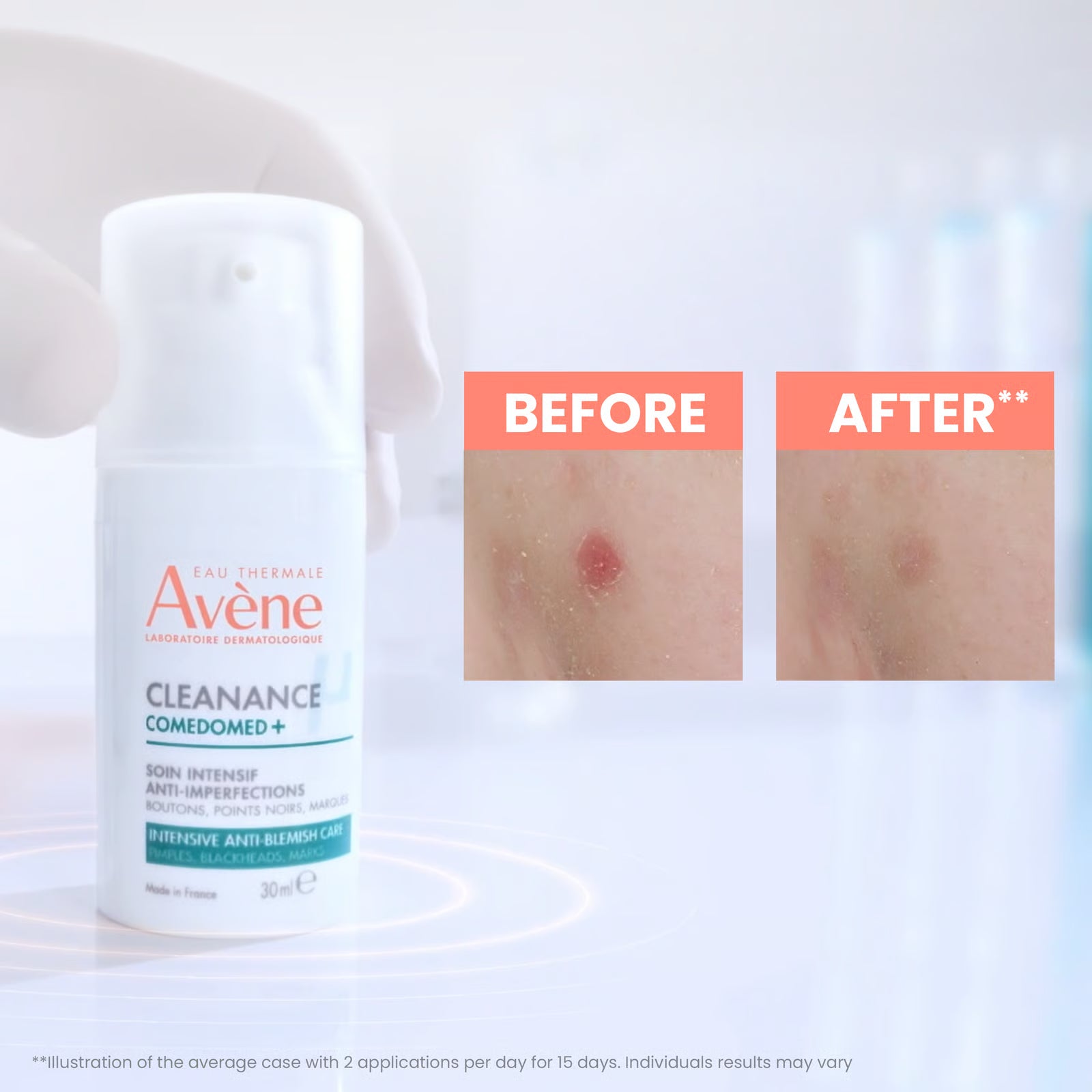 Avène Cleanance Comedomed+ Anti-Imperfections Intensive Care