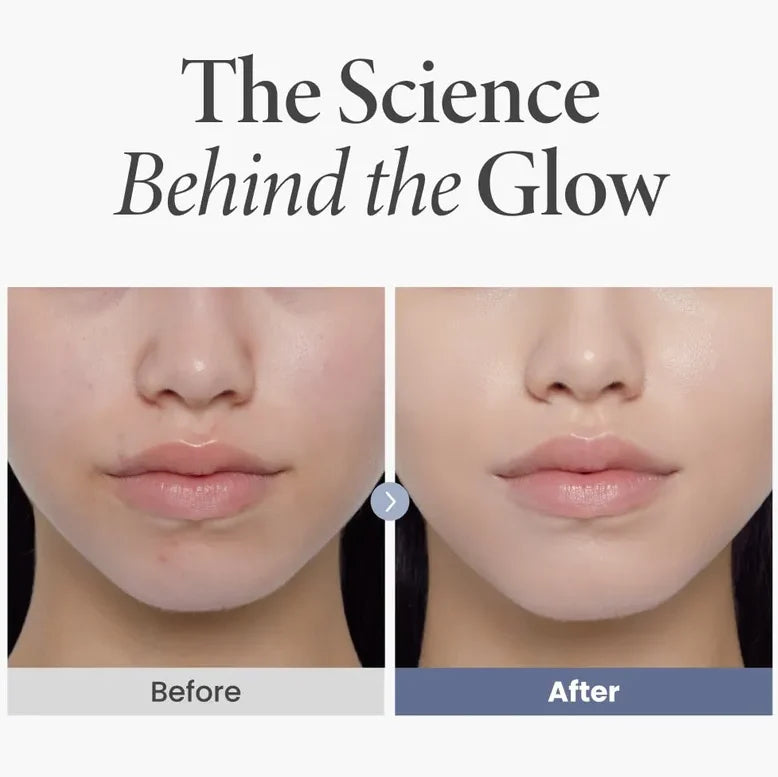 AXIS-Y TXA 2.5 % intensive brightening cream