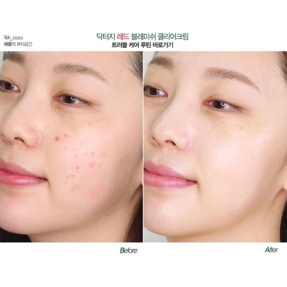 كريم دكتور جي لتفتيح البقع الحمراء