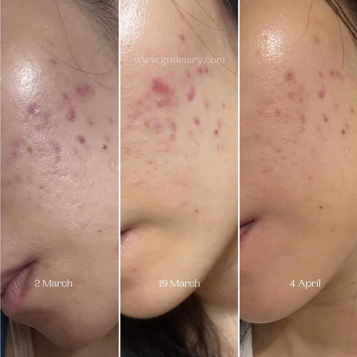 NUMBUZIN No.5 Vitamin Concentrated Serum