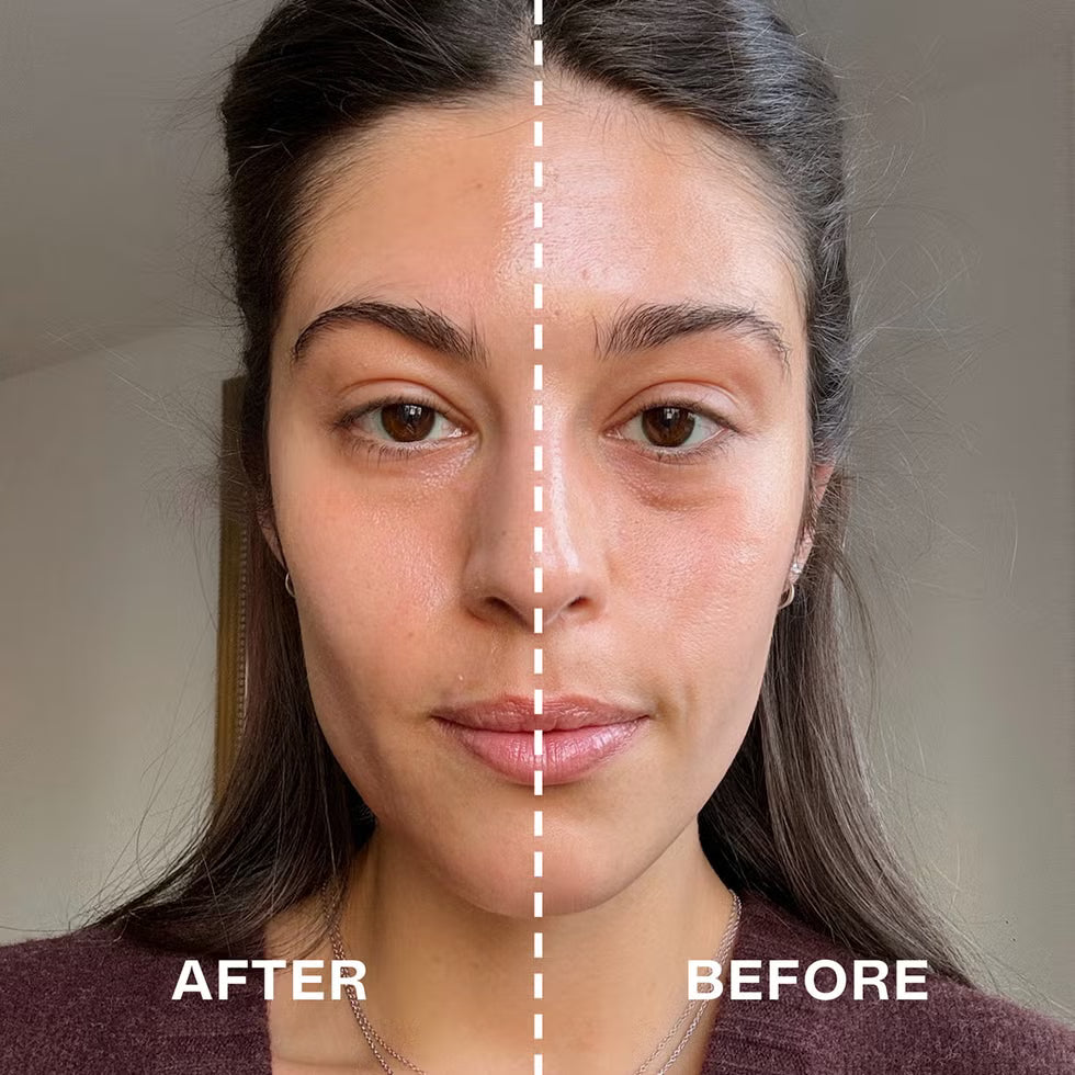 معزز Medicube AGE-R Pro