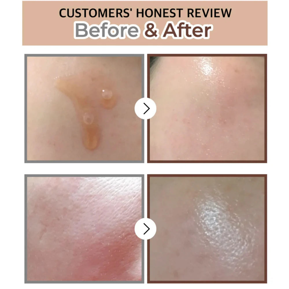 سيروم نامبوزين رقم 1 اللامع