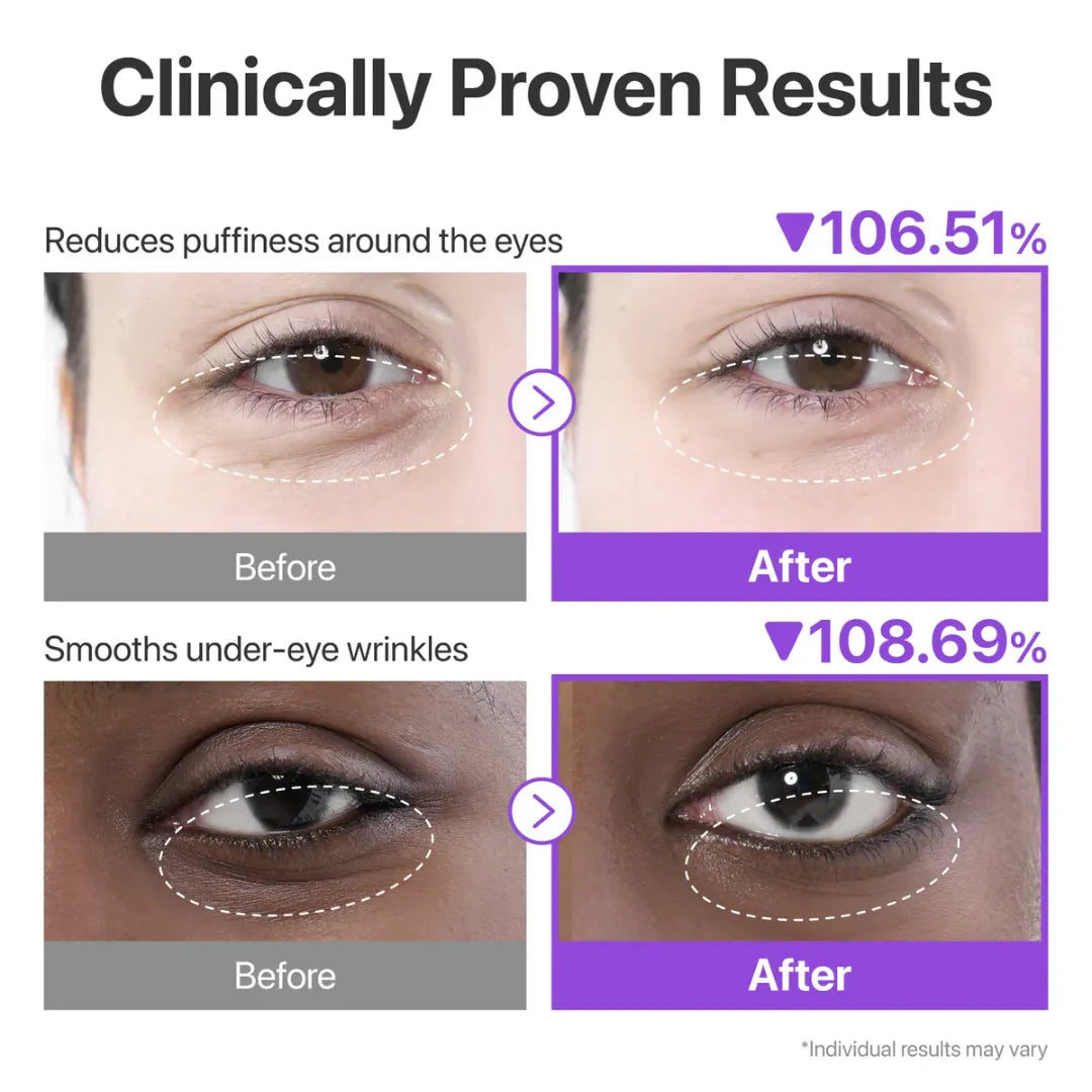 لصقات نومبوزين رقم 9 NAD كولاجين تحت العين