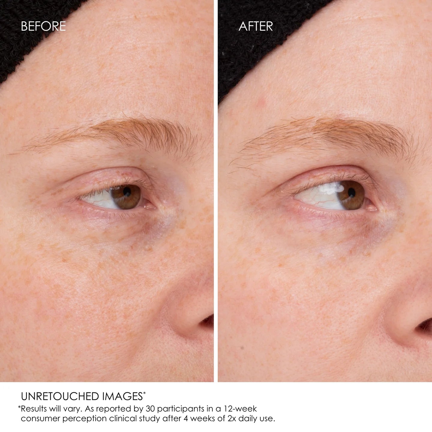 مصل بناء الحواجب من أولابلكس