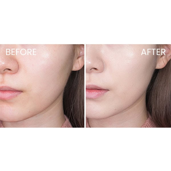 كبسولات تفتيح لون البشرة Skin1004 من مستخلص السنتيلا من مدغشقر