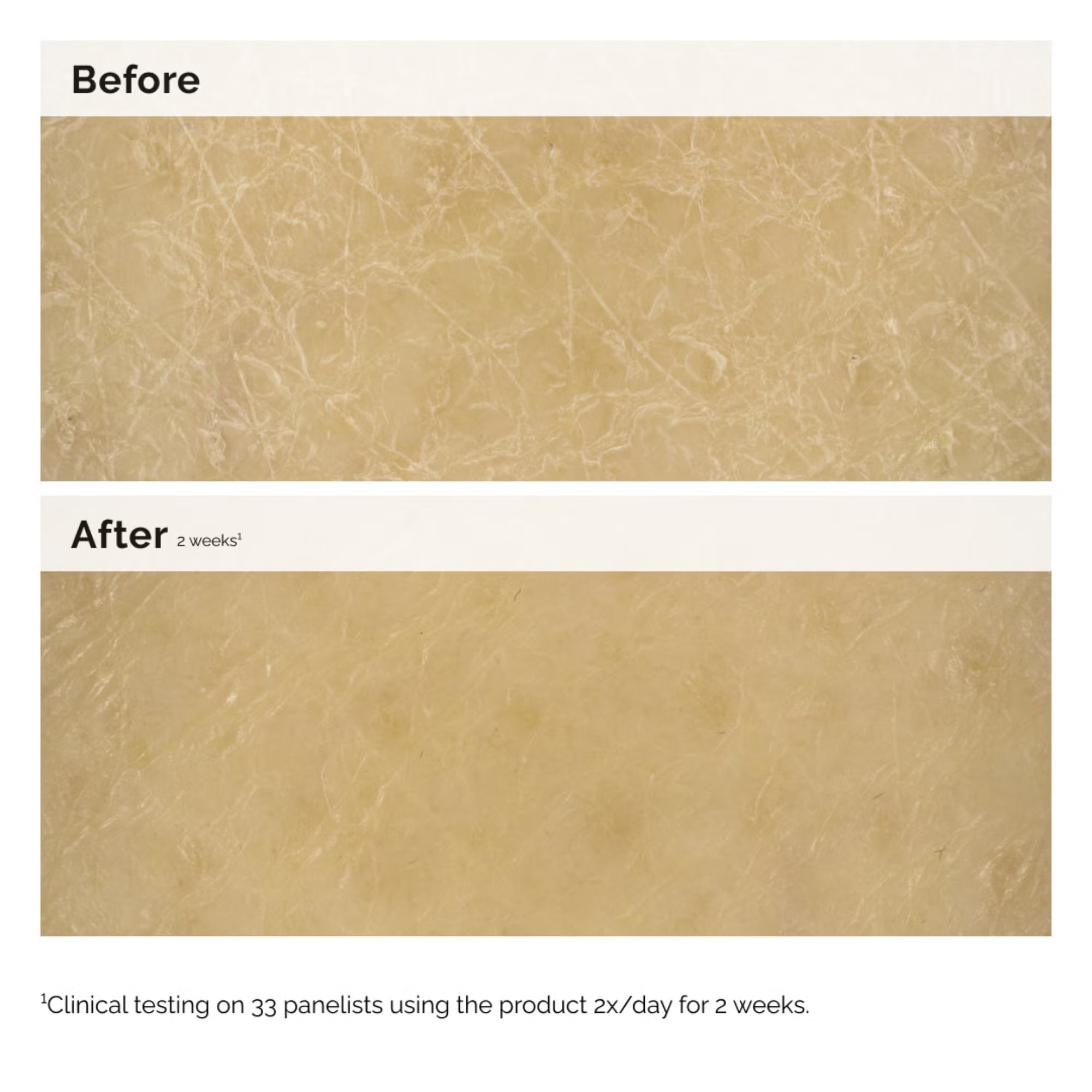 The Ordinary Natural Moisturizing Factors + Inulin Body Lotion