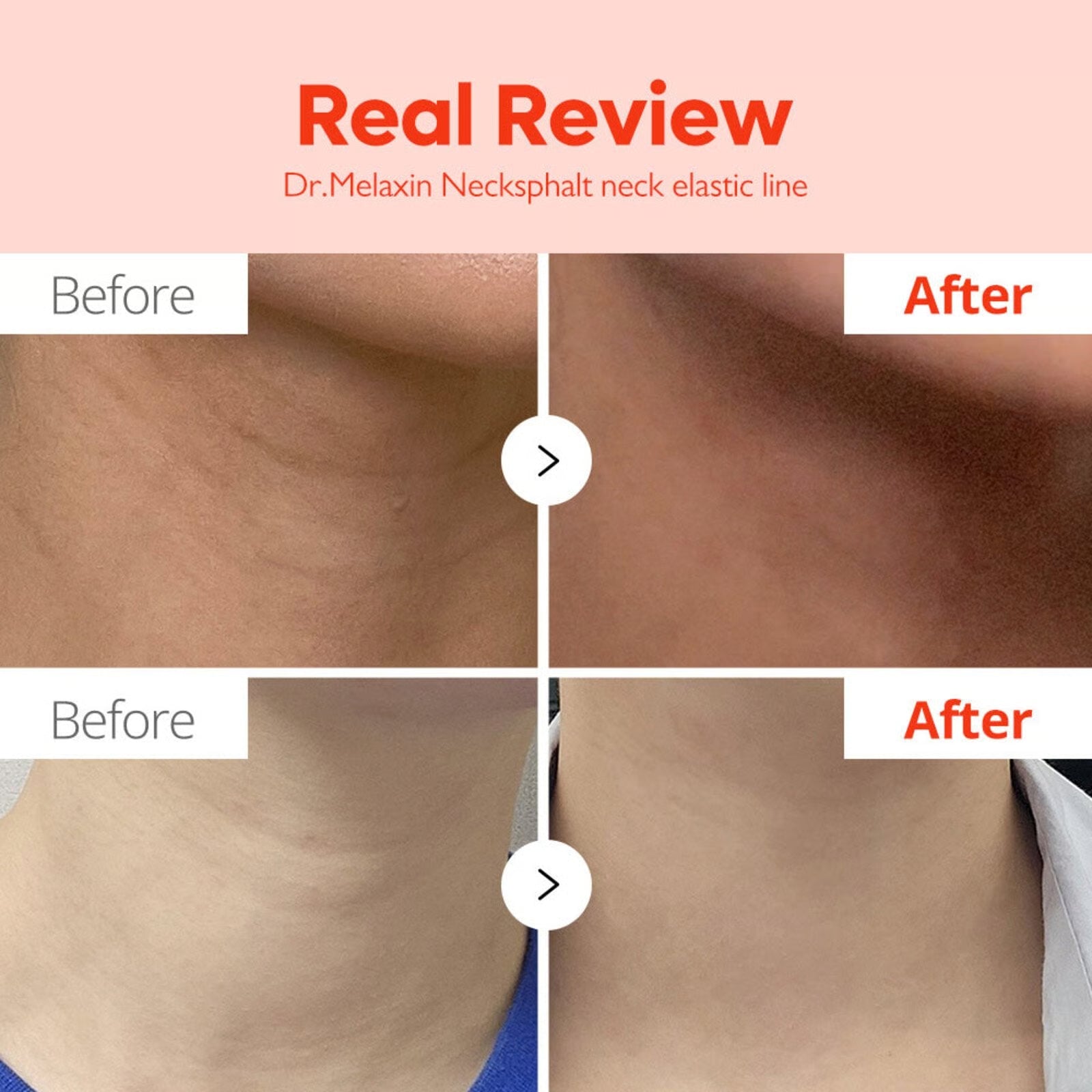 Dr.Melaxin Necksphalt ECM Neck Barrier Serum