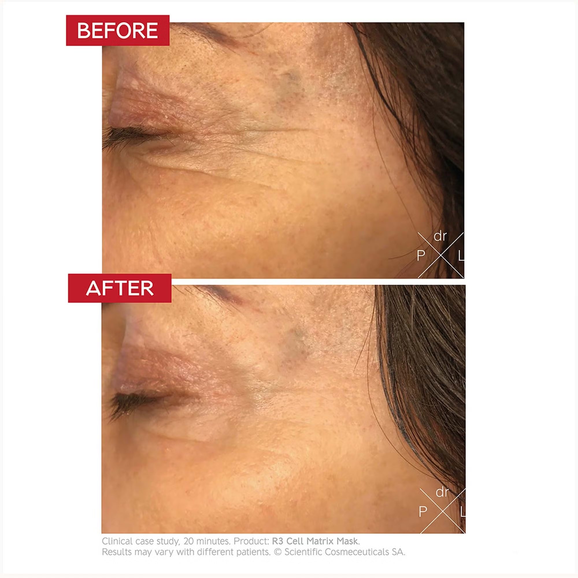Dr. LEVY Switzerland R3 Cell Matrix Mask