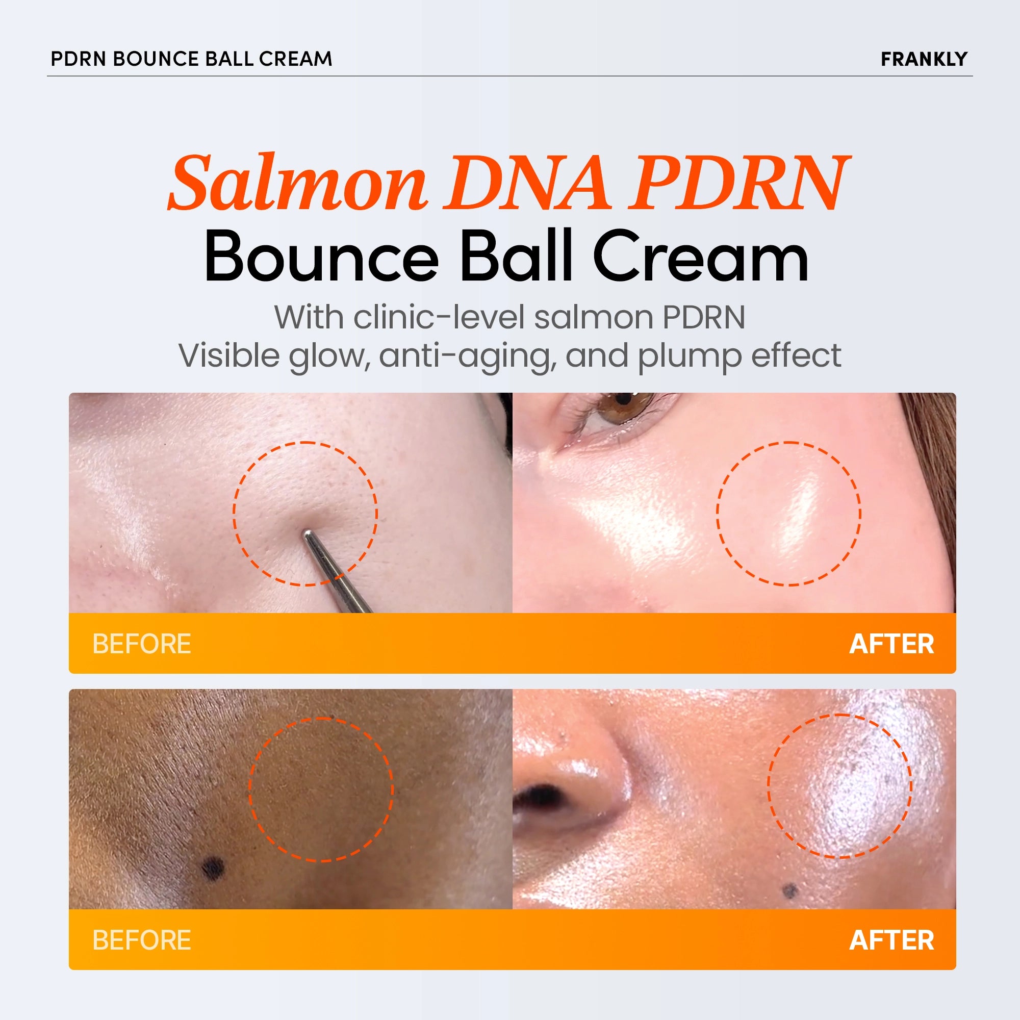 FRANKLY PDRN Bounce Ball Serum