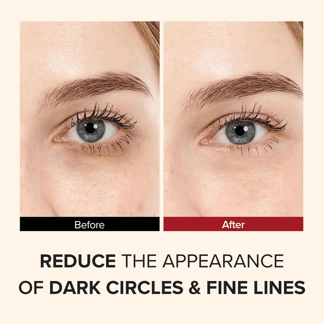 كريم العين ماري آند ماي بحمض الترانيكساميك والجلوتاثيون