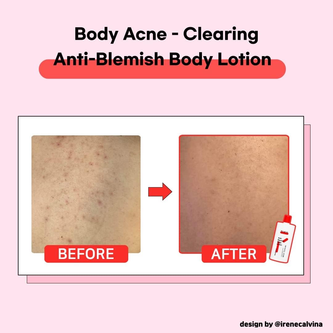 TIA'M Anti-Blemish Body Lotion
